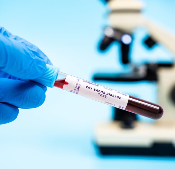 Blood sample labeled Tay-Sachs disease test held in a gloved hand