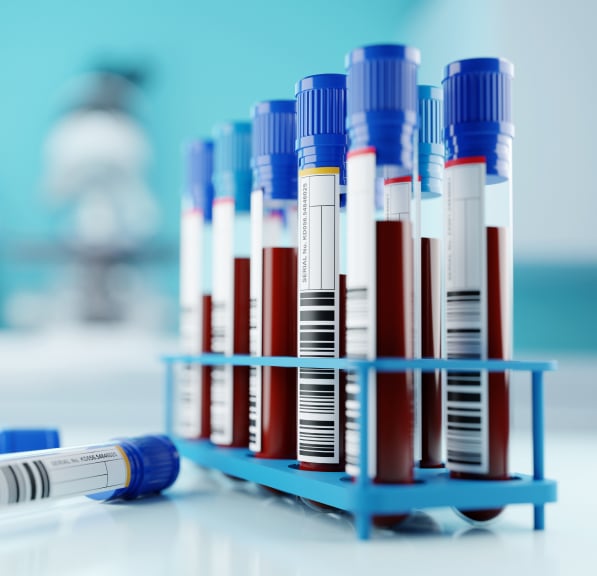 Blood sample tubes with blue caps in a laboratory rack